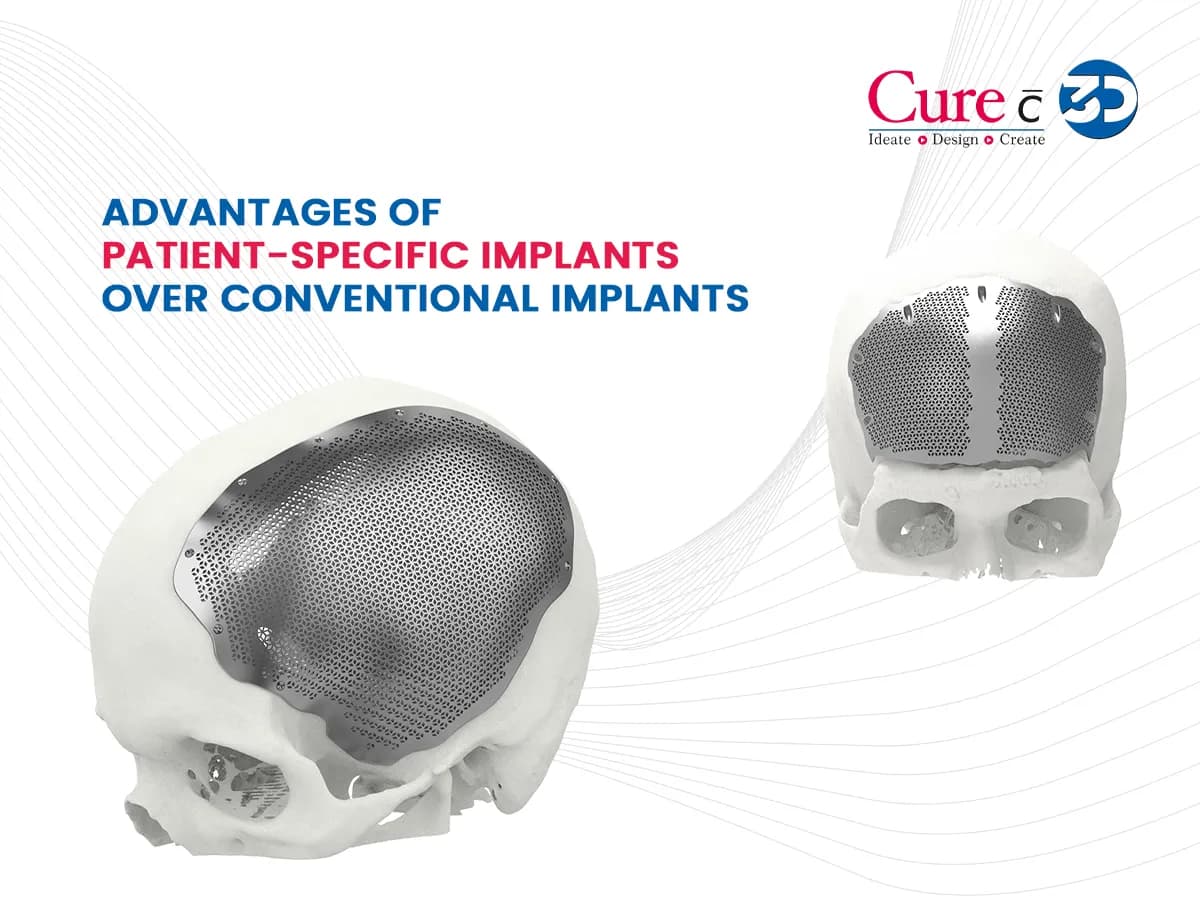Advanced Patient Implants for Modern Surgical Care

Curewith3D provides advanced patient implants ma...