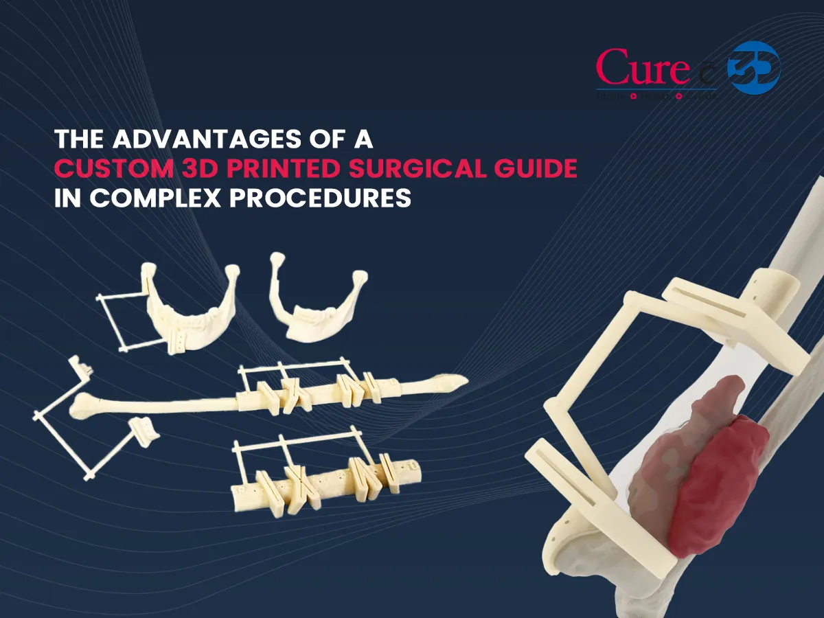 Enhancing Dental Precision with 3D Printed Surgical Guides

https://www.curewith3d.com/resources/blo...