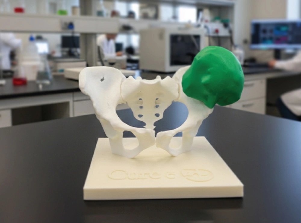 Customized 3D printed surgical guides designed for accurate and efficient surgical procedures