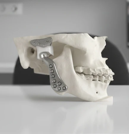 oral maxillofacial surgery