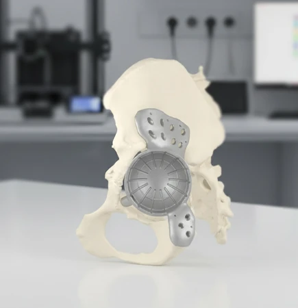 Orthopedics