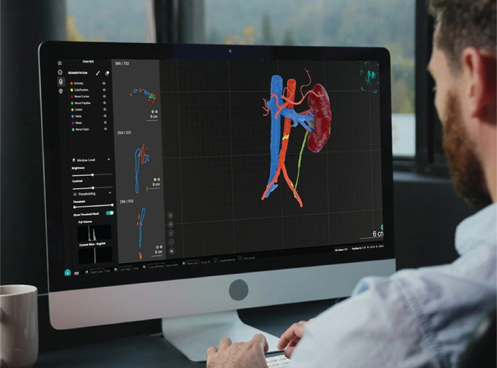Virtual surgical planning software used for precision healthcare and advanced surgical simulation