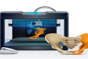 Beyond Plastic: Unveiling the World of Metal Implants via 3D Printing