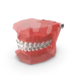 Jaw Model, curewith3d, Cure with 3D