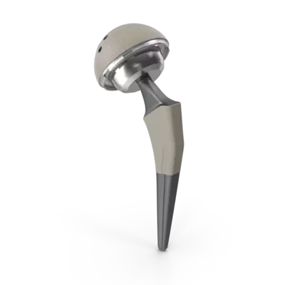 Implant Model, curewith3d, Cure with 3D