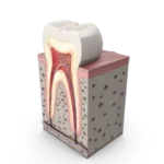 Tooth Model, curewith3d, Cure with 3D