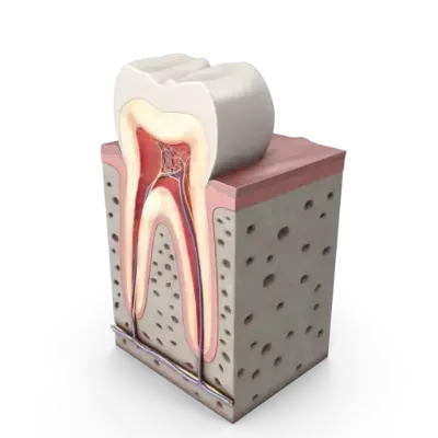 Tooth Model, curewith3d, Cure with 3D