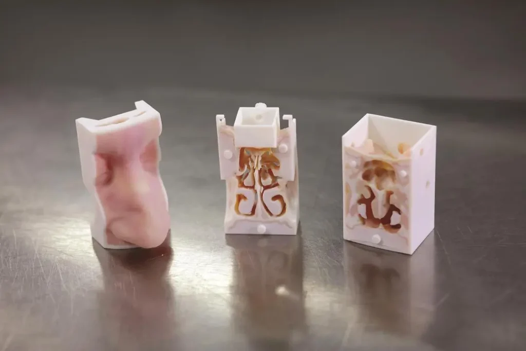 3D Printing technology Customizing Patient Implants