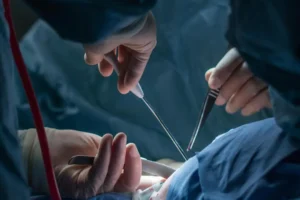 Exploring the Future: How 3D Printing is Redefining Surgical Innovation