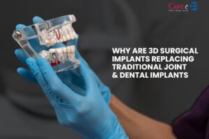 Why are 3D Surgical Implants Replacing Traditional Joint & Dental Implants?