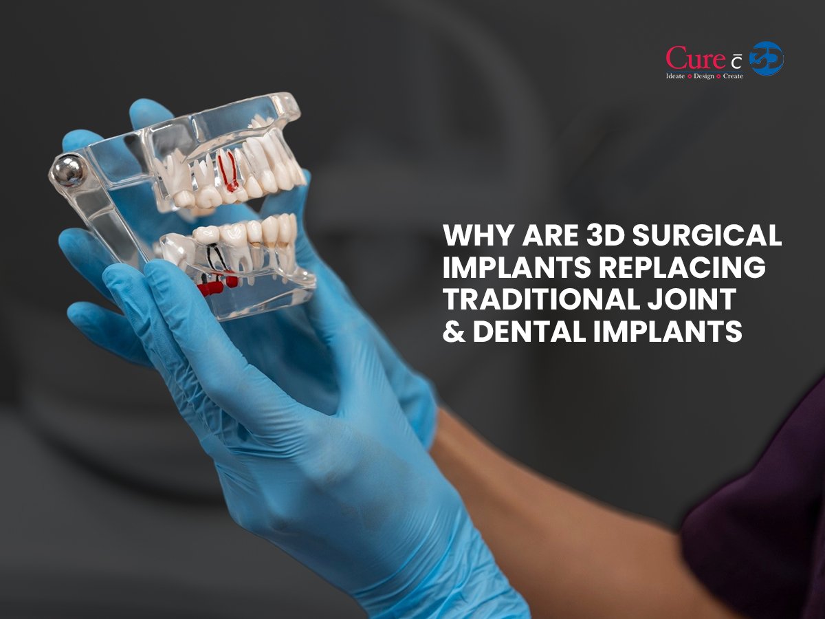 You are currently viewing Why are 3D Surgical Implants Replacing Traditional Joint & Dental Implants?